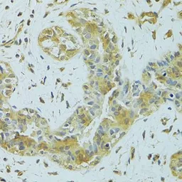 Anti-MTCH1 antibody used in IHC (Paraffin sections) (IHC-P). GTX55714