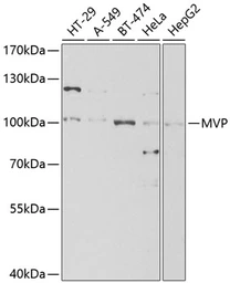 Anti-MVP/LRP antibody used in Western Blot (WB). GTX55715