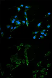 Anti-MVP/LRP antibody used in Immunocytochemistry/ Immunofluorescence (ICC/IF). GTX55715