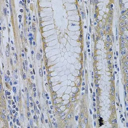 Anti-MVP/LRP antibody used in IHC (Paraffin sections) (IHC-P). GTX55715