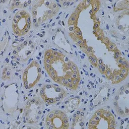 Anti-MVP/LRP antibody used in IHC (Paraffin sections) (IHC-P). GTX55715