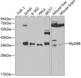 Anti-MyD88 antibody used in Western Blot (WB). GTX55716