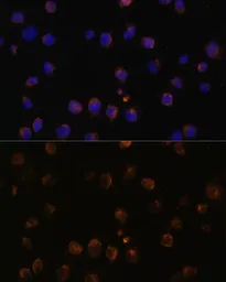 Anti-MyD88 antibody used in Immunocytochemistry/ Immunofluorescence (ICC/IF). GTX55716
