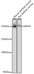 Anti-MYH1 antibody used in Western Blot (WB). GTX55717