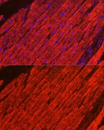 Anti-MYH1 antibody used in IHC (Paraffin sections) (IHC-P). GTX55717