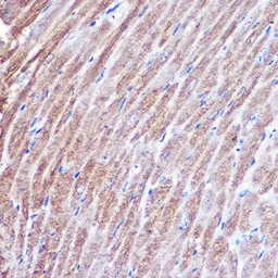 Anti-MYH1 antibody used in IHC (Paraffin sections) (IHC-P). GTX55717