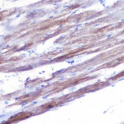 Anti-MYH1 antibody used in IHC (Paraffin sections) (IHC-P). GTX55717