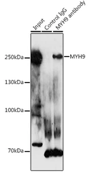 Anti-MYH9 antibody used in Immunoprecipitation (IP). GTX55718