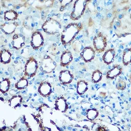 Anti-NDUFS4 antibody used in IHC (Paraffin sections) (IHC-P). GTX55722