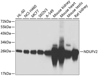 Anti-NDUFV2 antibody used in Western Blot (WB). GTX55724