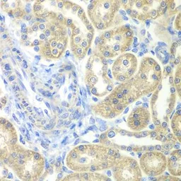 Anti-NDUFV2 antibody used in IHC (Paraffin sections) (IHC-P). GTX55724