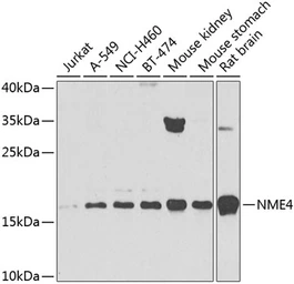 Anti-NME4 antibody used in Western Blot (WB). GTX55728