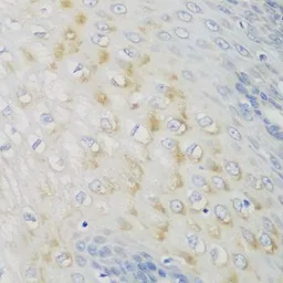 Anti-NME4 antibody used in IHC (Paraffin sections) (IHC-P). GTX55728