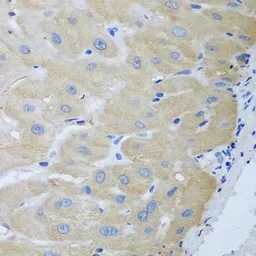 Anti-NME4 antibody used in IHC (Paraffin sections) (IHC-P). GTX55728
