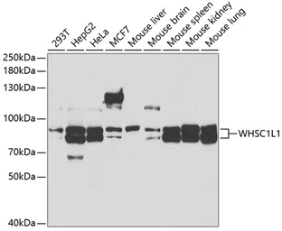 Anti-NSD3 antibody used in Western Blot (WB). GTX55733