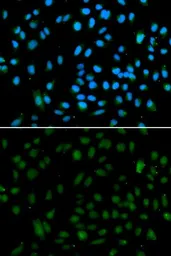 Anti-NSD3 antibody used in Immunocytochemistry/ Immunofluorescence (ICC/IF). GTX55733