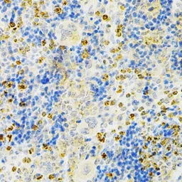 Anti-OPG antibody used in IHC (Paraffin sections) (IHC-P). GTX55734