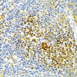 Anti-OPG antibody used in IHC (Paraffin sections) (IHC-P). GTX55734