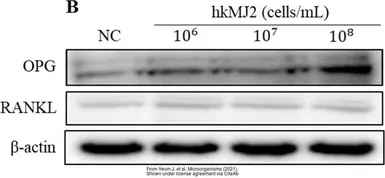 Anti-OPG antibody used in Western Blot (WB). GTX55734