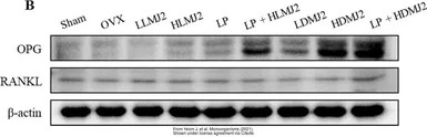 Anti-OPG antibody used in Western Blot (WB). GTX55734