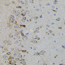 Anti-p38 beta antibody used in IHC (Paraffin sections) (IHC-P). GTX55736