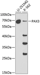 Anti-PAX3 antibody used in Western Blot (WB). GTX55738