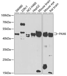 Anti-PAX6 antibody used in Western Blot (WB). GTX55739