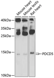 Anti-PDCD5 antibody used in Western Blot (WB). GTX55740