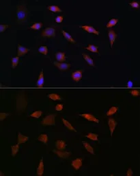 Anti-PDCD5 antibody used in Immunocytochemistry/ Immunofluorescence (ICC/IF). GTX55740