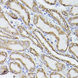 Anti-PDI antibody used in Immunoprecipitation (IP). GTX55742