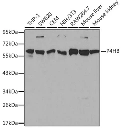 Anti-PDI antibody used in Western Blot (WB). GTX55742