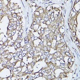 Anti-PDI antibody used in Immunocytochemistry/ Immunofluorescence (ICC/IF). GTX55742