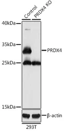 Anti-PRX IV antibody used in Western Blot (WB). GTX55743