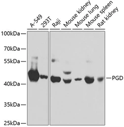 Anti-PGD antibody used in Western Blot (WB). GTX55744