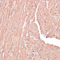 Anti-PGD antibody used in IHC (Paraffin sections) (IHC-P). GTX55744