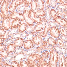 Anti-PGD antibody used in IHC (Paraffin sections) (IHC-P). GTX55744