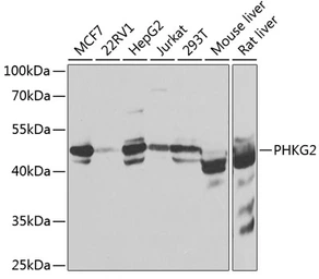 Anti-PHKG2 antibody used in Western Blot (WB). GTX55746