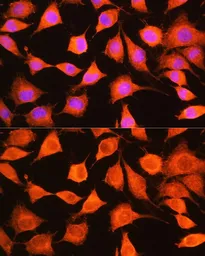 Anti-PHKG2 antibody used in Immunocytochemistry/ Immunofluorescence (ICC/IF). GTX55746