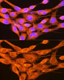 Anti-PHKG2 antibody used in Immunocytochemistry/ Immunofluorescence (ICC/IF). GTX55746