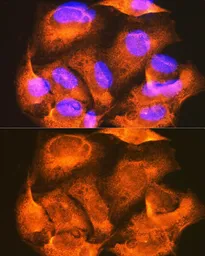 Anti-PHKG2 antibody used in Immunocytochemistry/ Immunofluorescence (ICC/IF). GTX55746