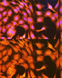 Anti-PHKG2 antibody used in Immunocytochemistry/ Immunofluorescence (ICC/IF). GTX55746
