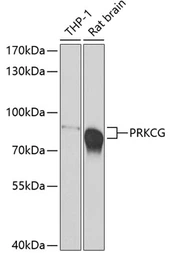 Anti-PKC gamma antibody used in Western Blot (WB). GTX55750
