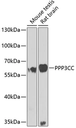 Anti-PPP3CC antibody used in Western Blot (WB). GTX55755