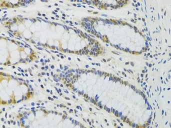 Anti-PPP4C antibody used in IHC (Paraffin sections) (IHC-P). GTX55756