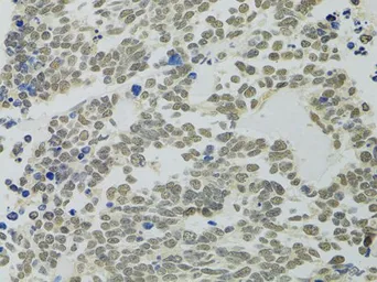 Anti-PPP4C antibody used in IHC (Paraffin sections) (IHC-P). GTX55756
