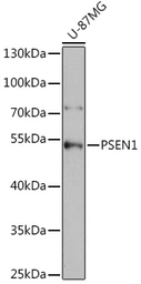 Anti-Presenilin 1 antibody used in Western Blot (WB). GTX55757
