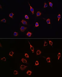 Anti-Presenilin 1 antibody used in Immunocytochemistry/ Immunofluorescence (ICC/IF). GTX55757