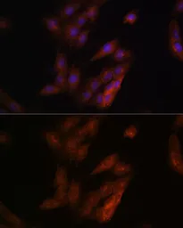 Anti-Presenilin 1 antibody used in Immunocytochemistry/ Immunofluorescence (ICC/IF). GTX55757