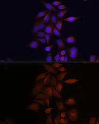 Anti-Presenilin 1 antibody used in Immunocytochemistry/ Immunofluorescence (ICC/IF). GTX55757