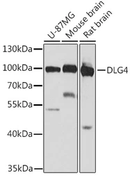 Anti-PSD95 antibody used in Western Blot (WB). GTX55760